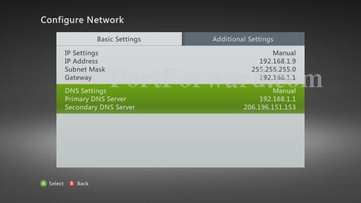 Xbox 360 Configure Network Screen Highlighted DNS